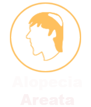 Alopecia-Areta